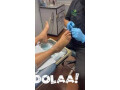 ingrown-nail-removal-near-me-small-0