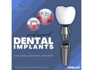 Dental implants Summerlin