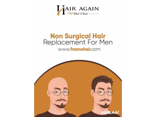 Non Surgical Hair Restoration