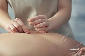 chinese-acupuncture-in-brooklyn-balance-energy-heal-holistically-big-0